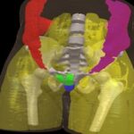 3D-DOCTOR and models created